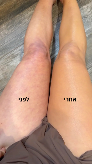 אורית ב.